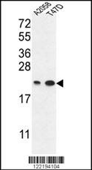 ABHEB Antibody (C-term)