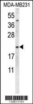 NEU1 Antibody (Center)