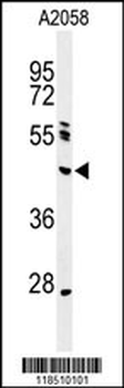 NEIL1 Antibody (Center)