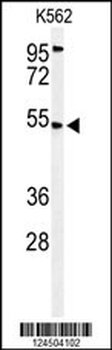 CBAA1 Antibody (N-term)