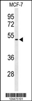 FLVC2 Antibody (C-term)
