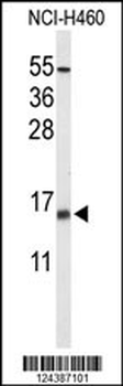 KCE1L Antibody (Center)