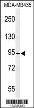 CF097 Antibody (C-term)