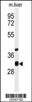 ECHDC1 Antibody (C-term)