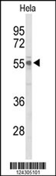 UPF3B Antibody (Center)