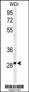 NMRK1 Antibody (N-term)