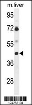 B3GNT5 Antibody (Center)
