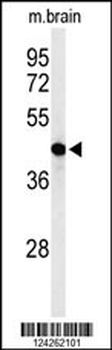 AGPAT6 Antibody (N-term)