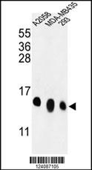 RPL36 Antibody (N-term)