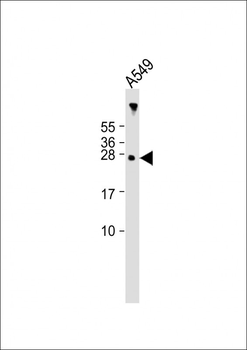 AANAT Antibody (N-term)