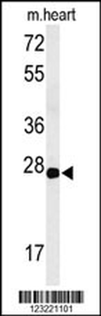 CLDN4 Antibody (C-term)