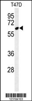 CLPB Antibody (C-term)