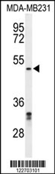 CBX2 Antibody (N-term)