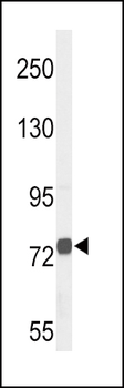 CHAT Antibody (N-term)