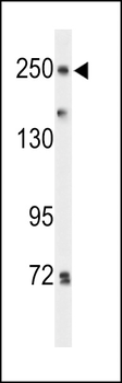 PTPRD Antibody (N-term)