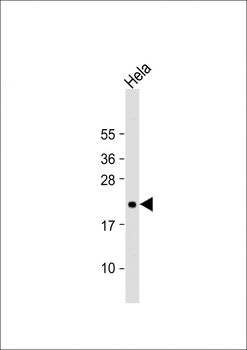 TIFA Antibody (N-term)