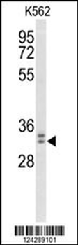MORG1 Antibody (Center)