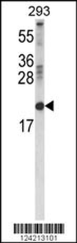 RBP2 Antibody (Center)