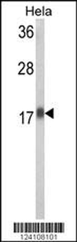 RPL31 Antibody (Center)