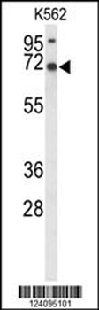 LRRC4 Antibody (C-term)