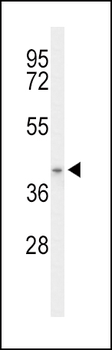 ACAD8 Antibody (Center)