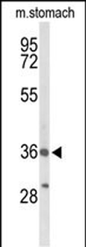 BRS3 Antibody (Center)