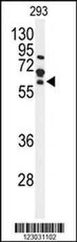 FZD4 Antibody (C-term)