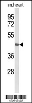 DBC1 Antibody (N-term)