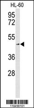 SLC1A5 Antibody (Center)