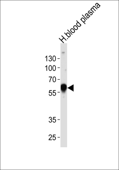 SERPINA1 Antibody (Center)