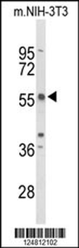 TAC2N Antibody (N-term)