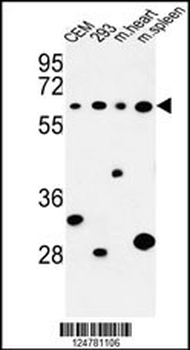 PLCZ1 Antibody (N-term)