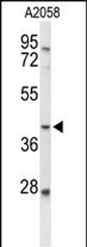 FUT3 Antibody (C-term)