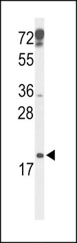 p19 Antibody (N-term)