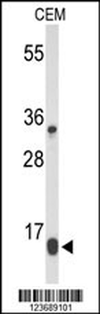 DIRAS1 Antibody (Center)