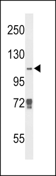 JMJD2B Antibody (N-term)