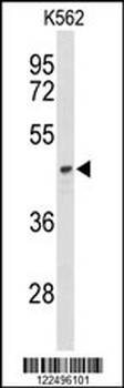 ND2 Antibody (N-term)