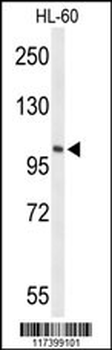 LIPE Antibody (C-term)