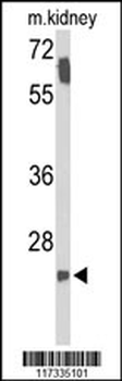 SMNDC1 Antibody (N-term)