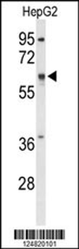 ATLA2 Antibody (Center)