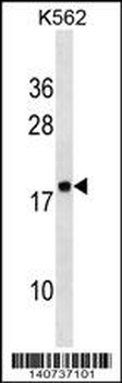 RPLP2 Antibody (N-Term)