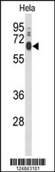 PCAT1 Antibody (C-term)