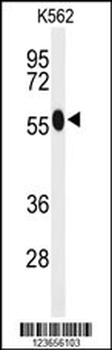 ACSM1 Antibody (N-term)