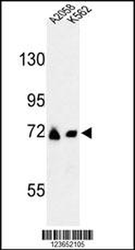 GFPT2 Antibody (Center)