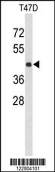 KCTD12 Antibody (Center)