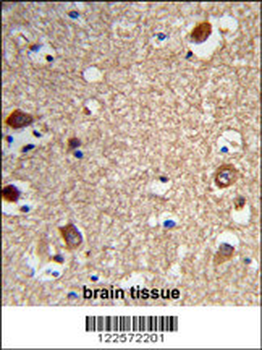ACTR5 Antibody (C-term)