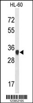 ATP5C1 Antibody (N-term)