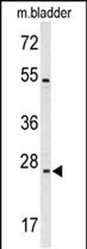 TSPAN6 Antibody (C-term)