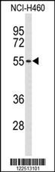 ACCN1 Antibody (Center)
