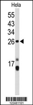 CENPH Antibody (Center)
